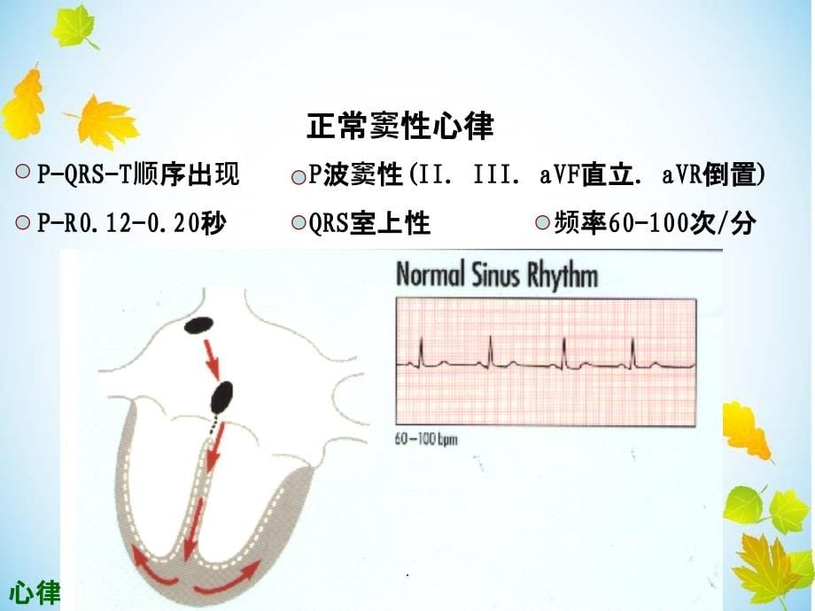 心内科常见心电图的诊断及处理ppt课件_第5页