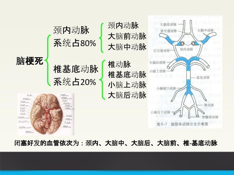 脑梗死康复训练ppt课件_第5页