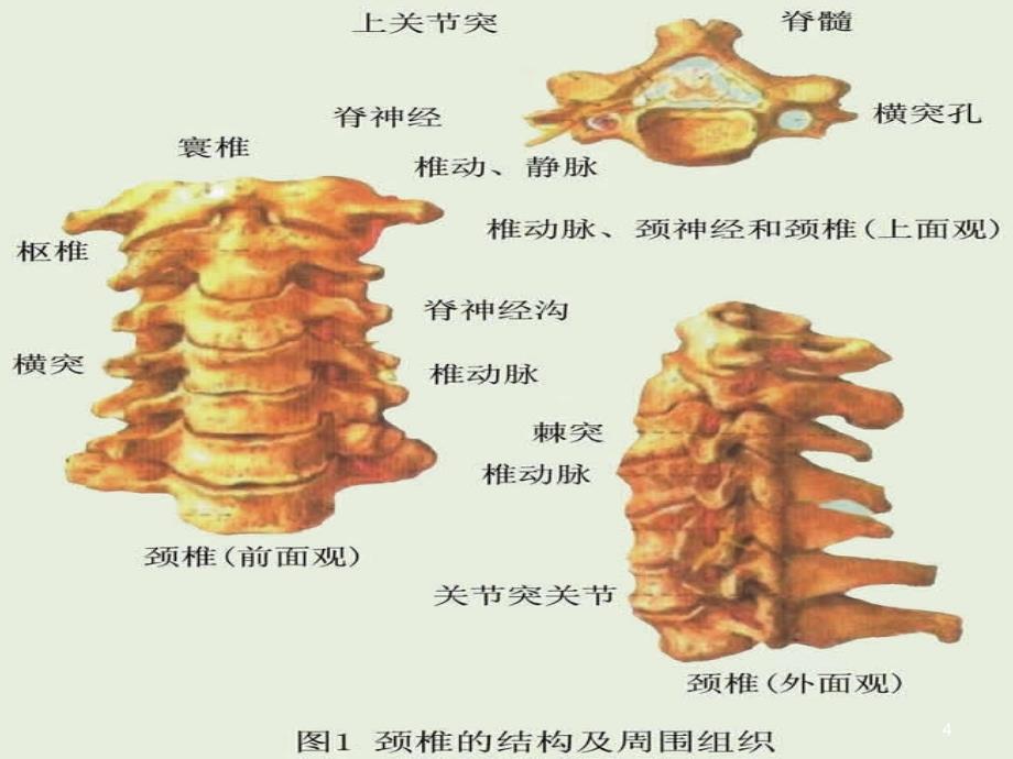 骨X线读片PPT参考幻灯片_第4页