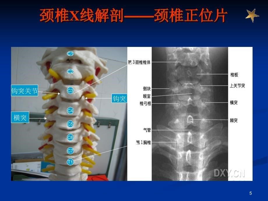 骨X线读片PPT参考幻灯片_第5页