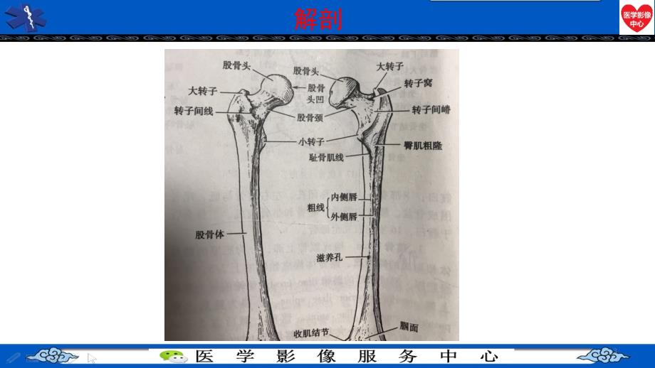 股骨头缺血坏死-PPT参考幻灯片_第3页