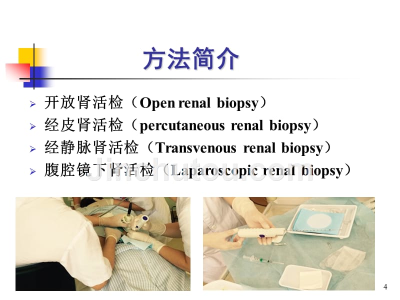 肾穿刺活检术的准备和操作方法PPT参考幻灯片_第4页