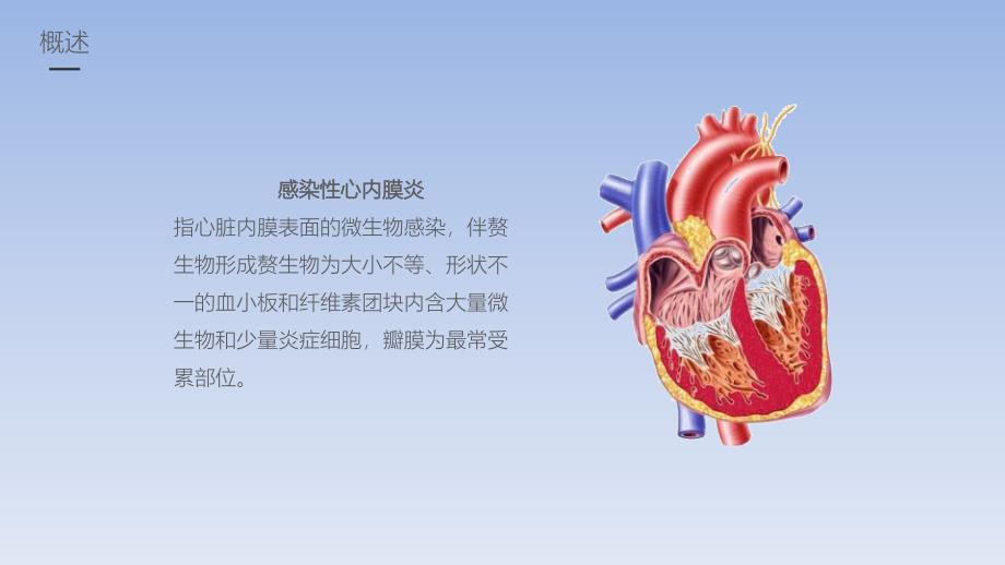 感染性心内膜炎患者护理课件PPT模板(图文)_第4页