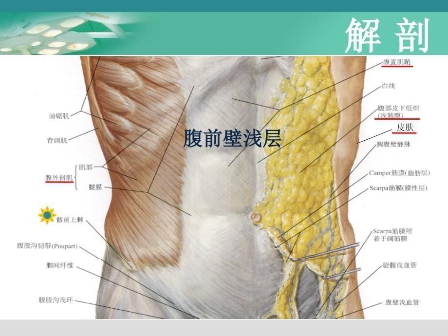 超声引导下腹横肌平面阻滞教学提纲_第5页