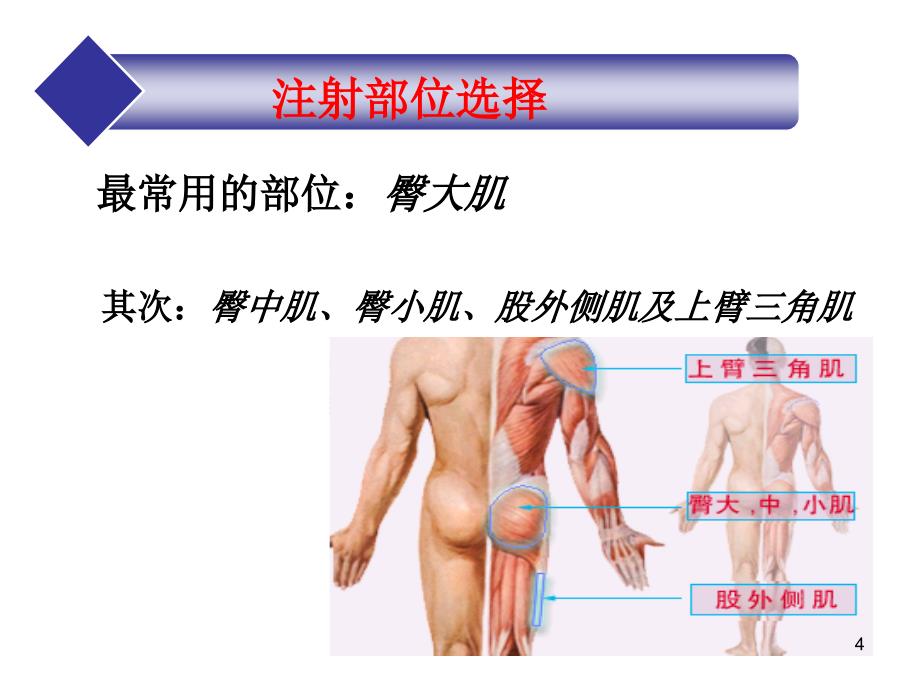 肌肉注射法PPT参考幻灯片_第4页