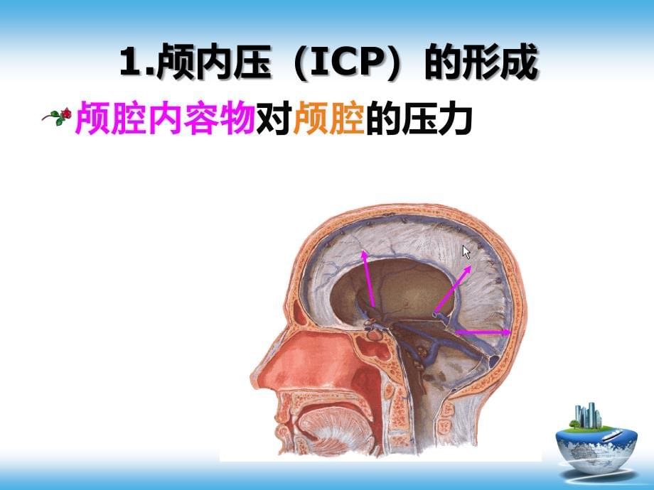 颅脑疾病病人的护理PPT参考幻灯片_第5页