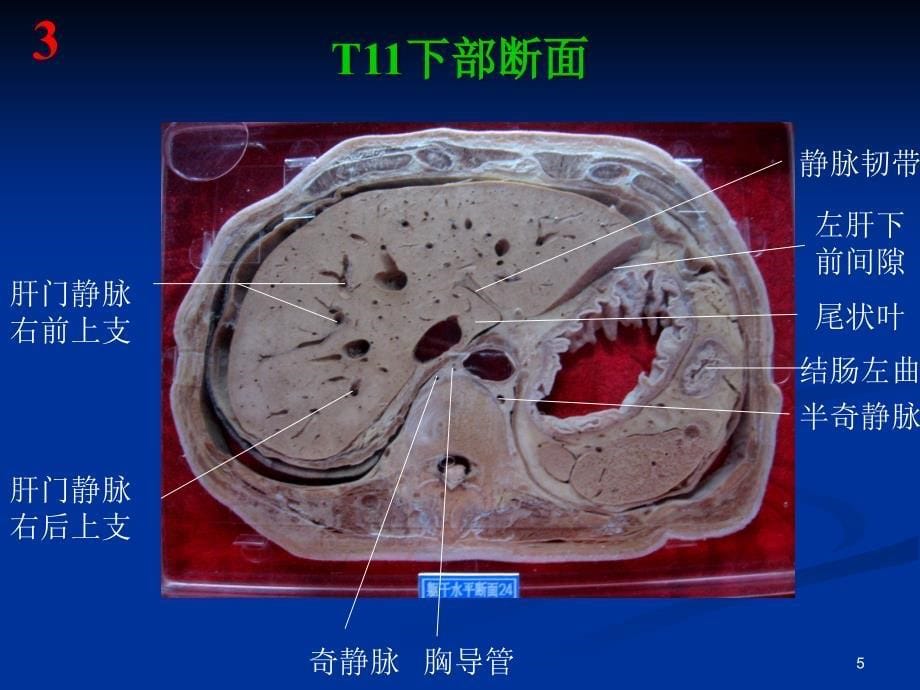 断层解剖 高清图PPT参考幻灯片_第5页