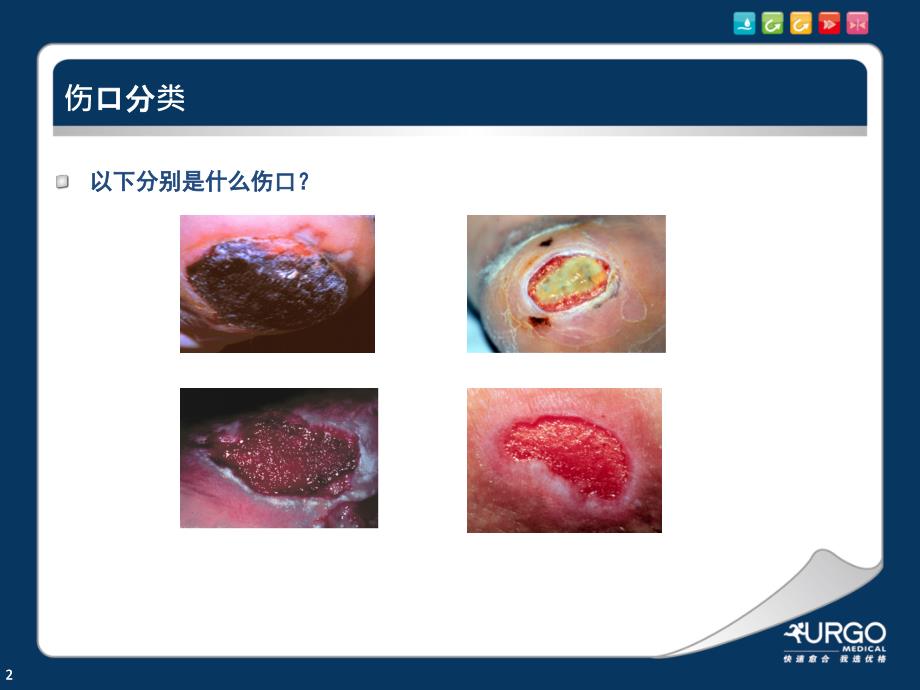 敷料的选择PPT参考幻灯片_第2页