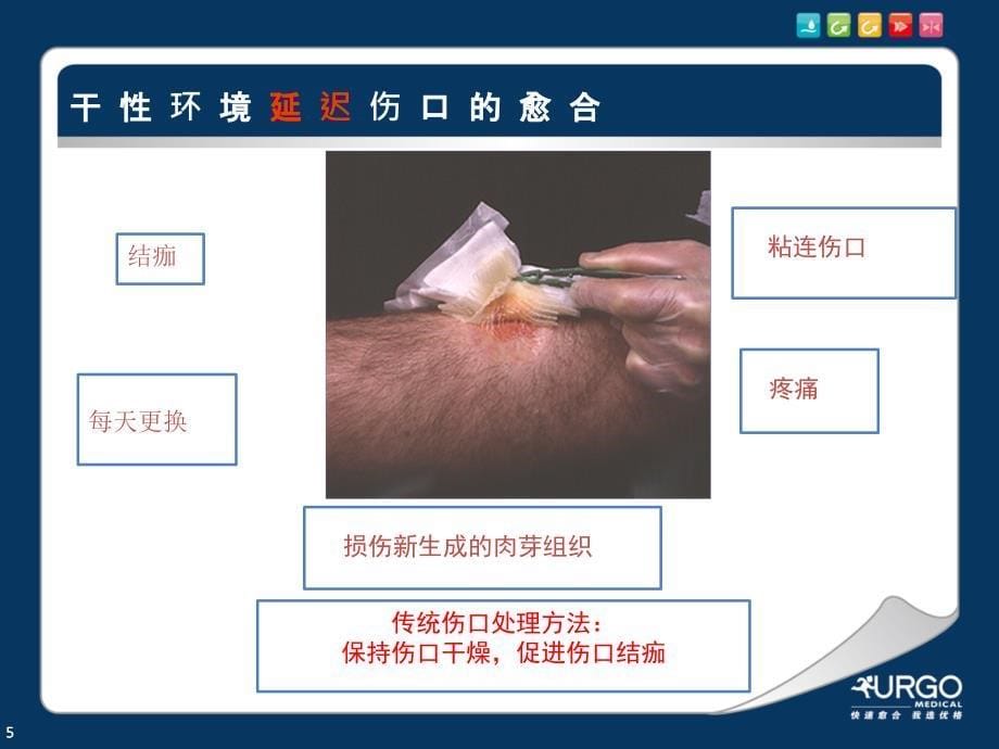 敷料的选择PPT参考幻灯片_第5页