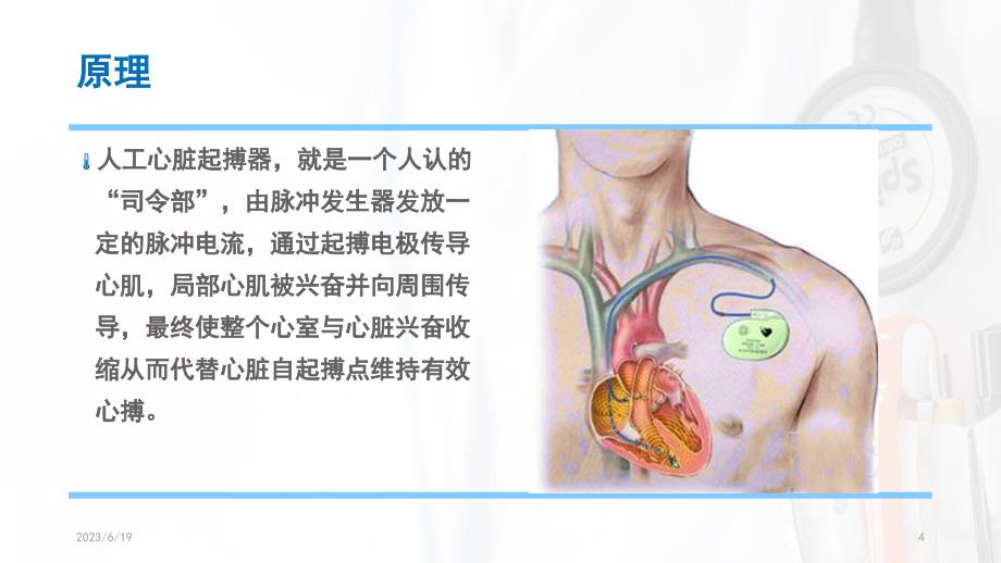 永久性心脏起搏器植入术后护理PPT参考幻灯片_第4页