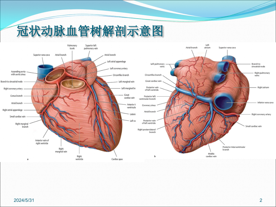 冠状动脉造影识图CCU-PPT参考幻灯片_第2页