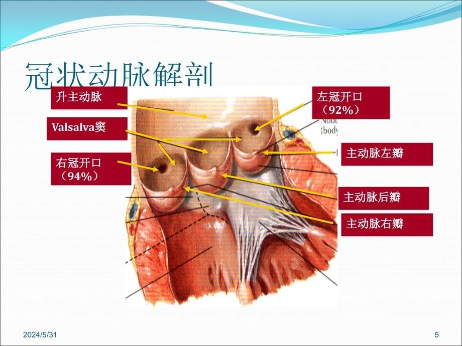 冠状动脉造影识图CCU-PPT参考幻灯片_第5页