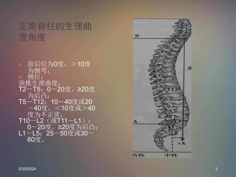 脊柱疾病X光片阅片要求PPT参考幻灯片_第3页