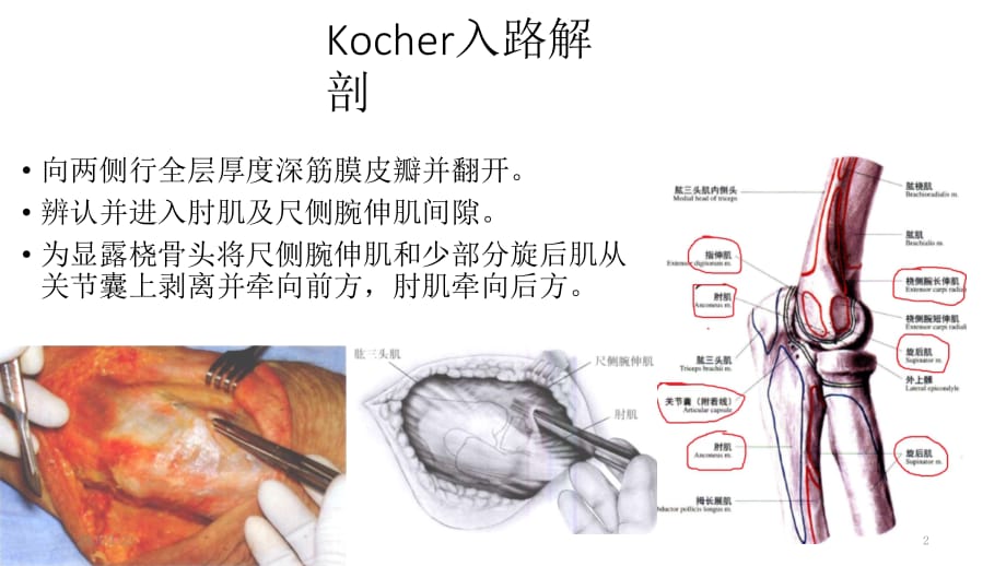 肘关节外侧入路解剖PPT参考幻灯片_第2页