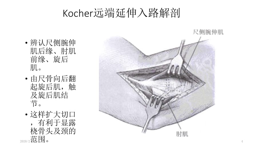 肘关节外侧入路解剖PPT参考幻灯片_第4页