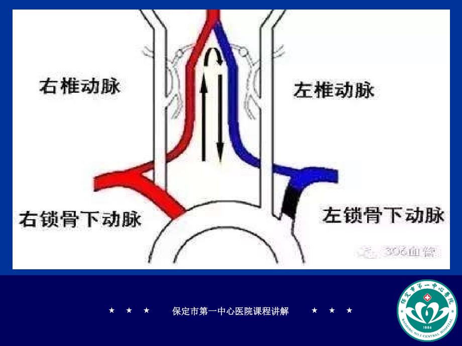 锁骨下静脉立体解剖图.ppt_第3页