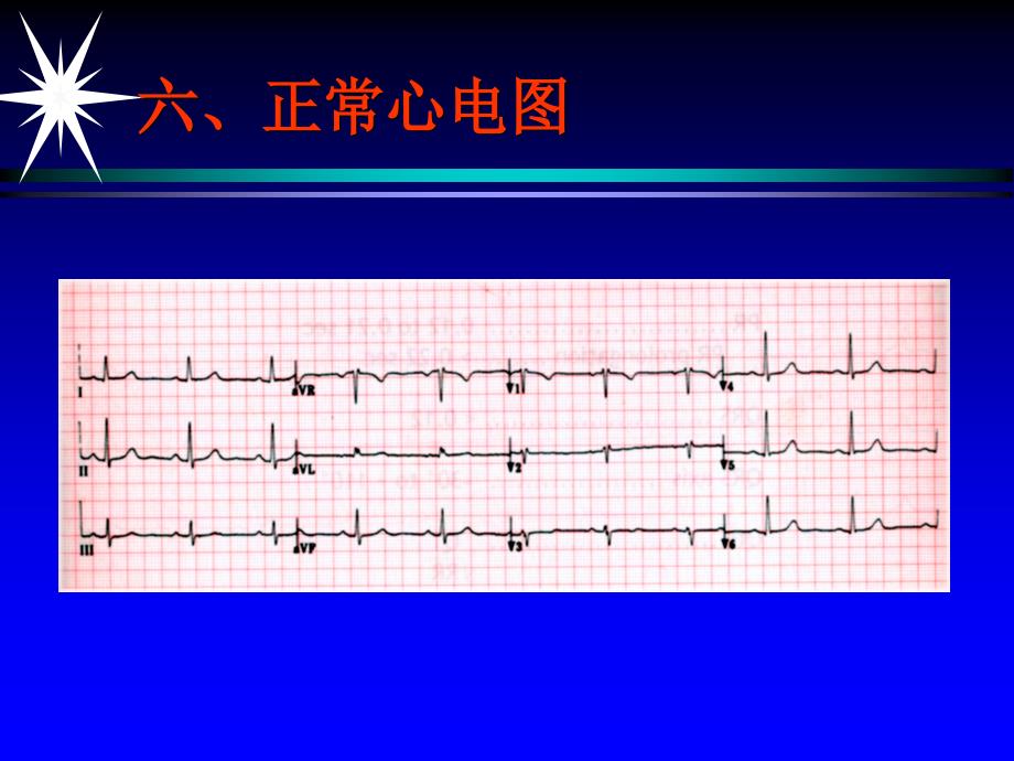 郭继鸿心电图(下)讲课教案_第2页