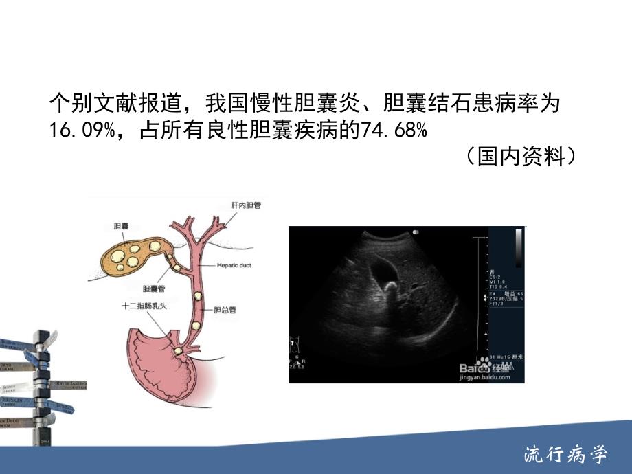 中国慢性胆囊炎、胆囊结石知识PPT课件_第4页