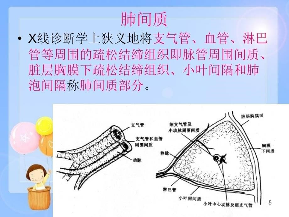 双肺弥漫性病变的诊断与鉴别诊断PPT参考幻灯片_第5页