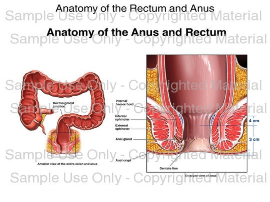 直肠、肛管疾病基本知识PPT课件_第4页
