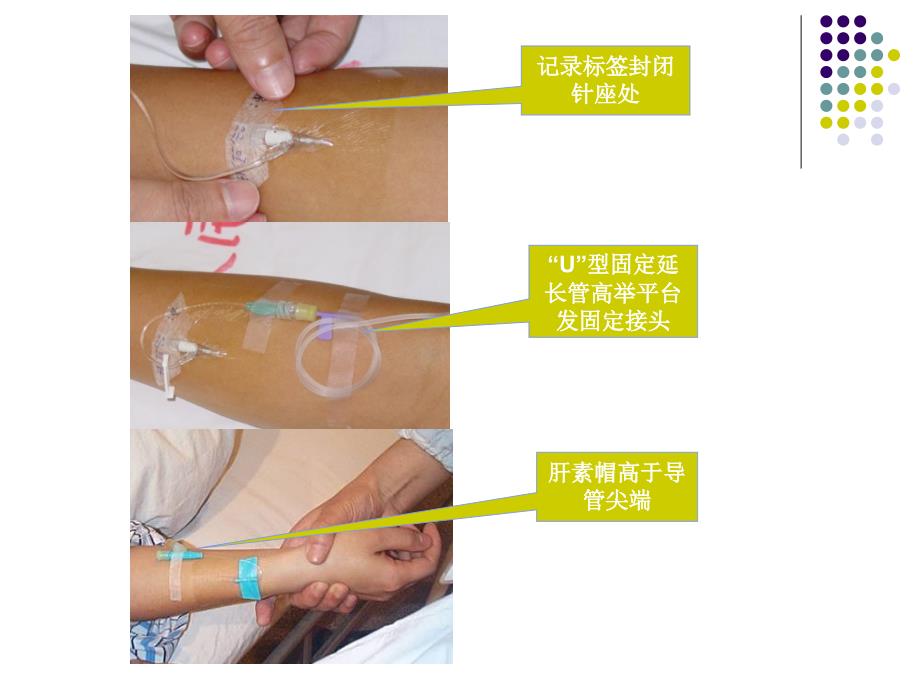 透明敷贴使用培训_第4页