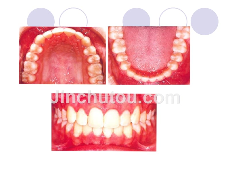 牙体外部形态知识PPT课件_第2页
