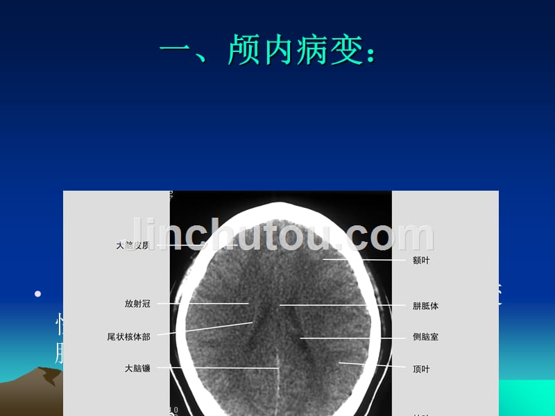 CT检查适应症分析_第4页