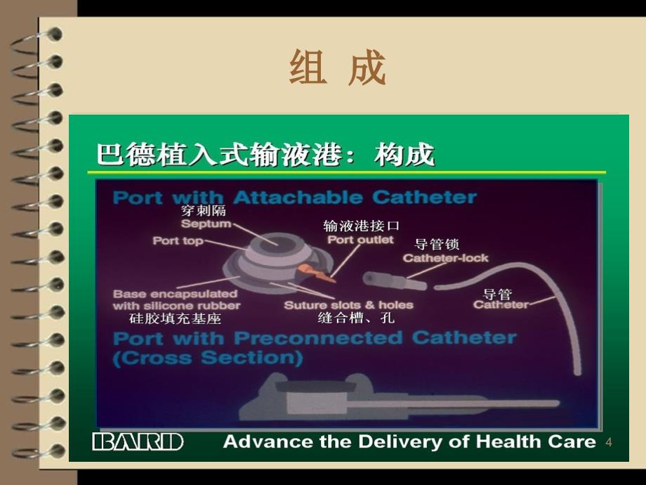 浅谈输液港PPT课件.ppt_第4页