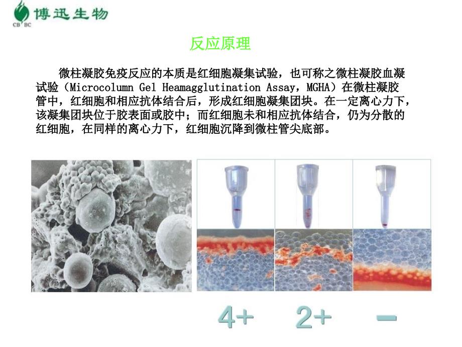 微柱凝胶免疫检测技术知识PPT课件_第4页