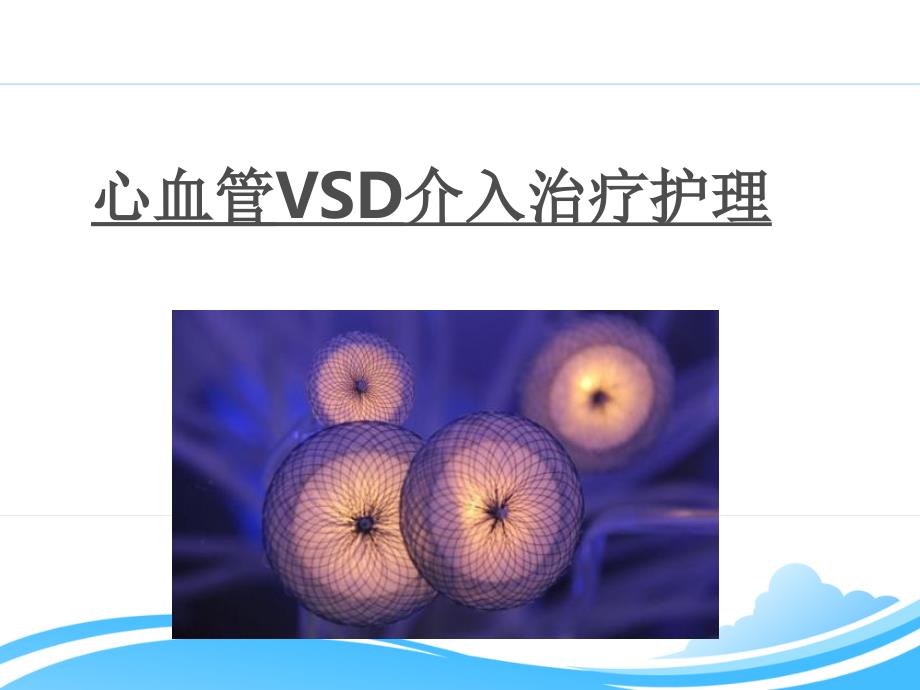 VSD介入术前术后护理_第1页