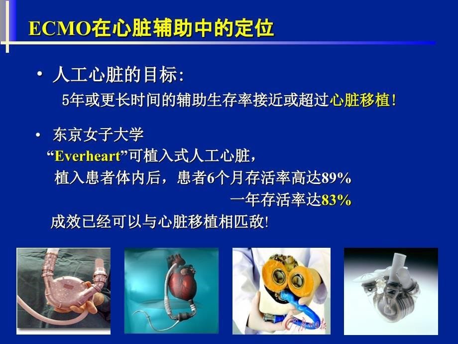 ECMO在心脏辅助中的应用_第5页