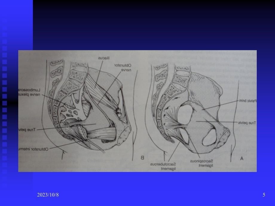 骨盆的临床解剖知识PPT课件_第5页