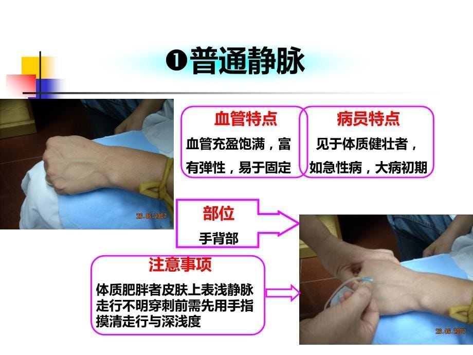 静脉输液穿刺技巧(完整版本).ppt_第5页