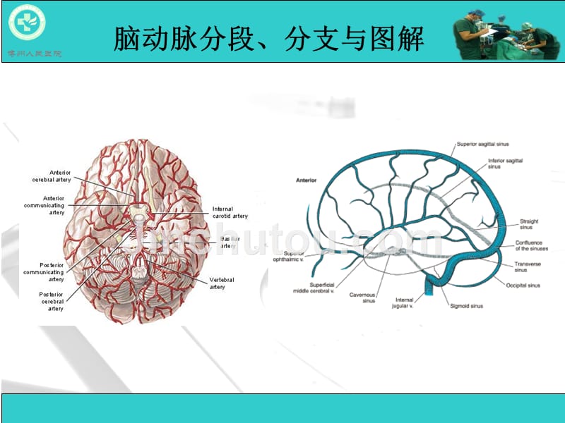 脑动脉解剖与CT重建D.ppt_第2页