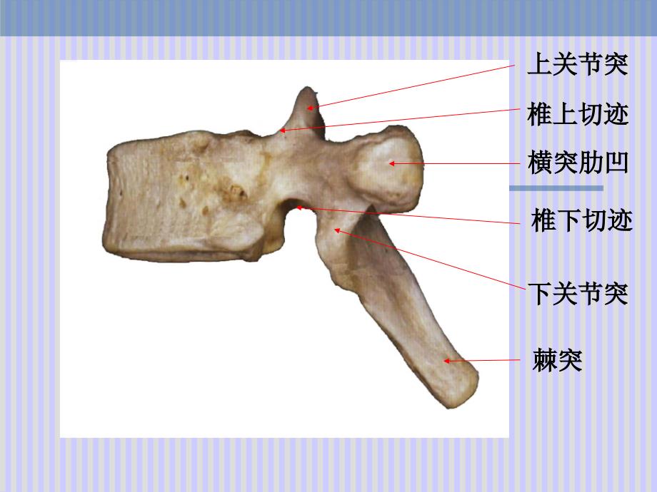 脊柱解剖图(整理版本).ppt_第4页