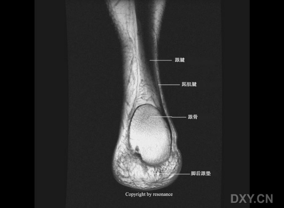 踝关节MRI解剖_第2页