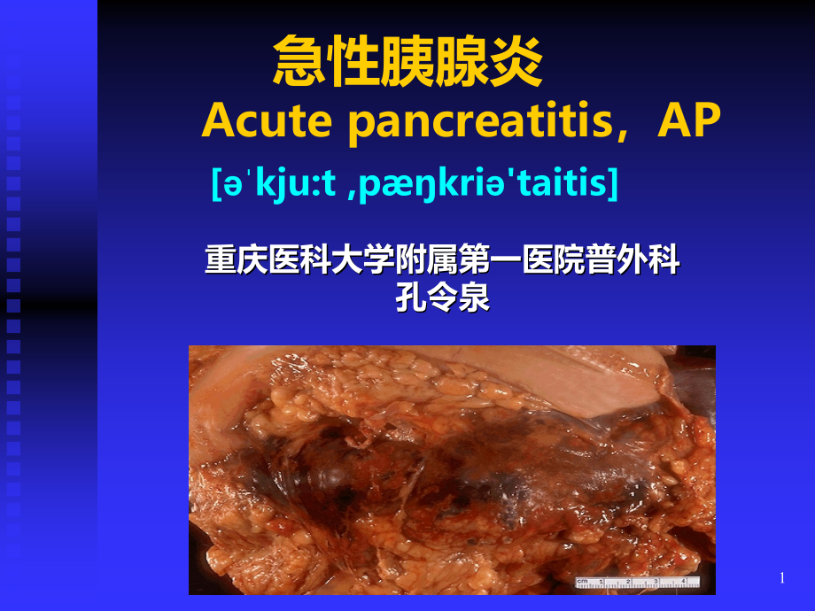 急性胰腺炎优秀PPT课件.ppt_第1页