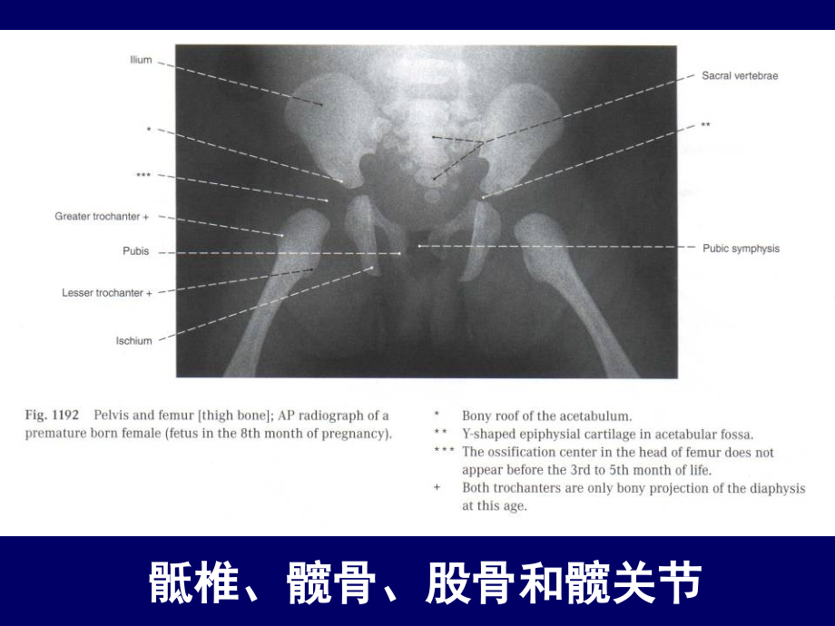 下肢的断层解剖-人体断层解剖学-课件完整版本.ppt_第3页