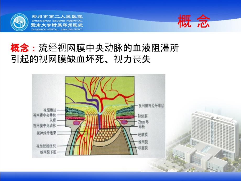 视网膜中央动脉阻塞完整版本.ppt_第2页