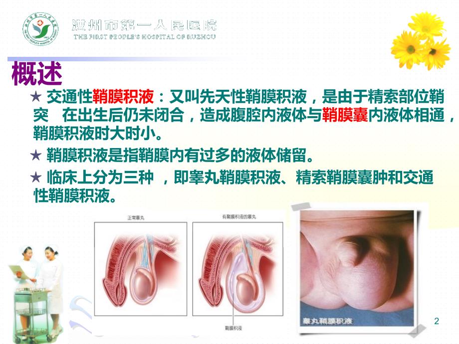 小二鞘膜积液健康教育内容PPT课件.ppt_第2页