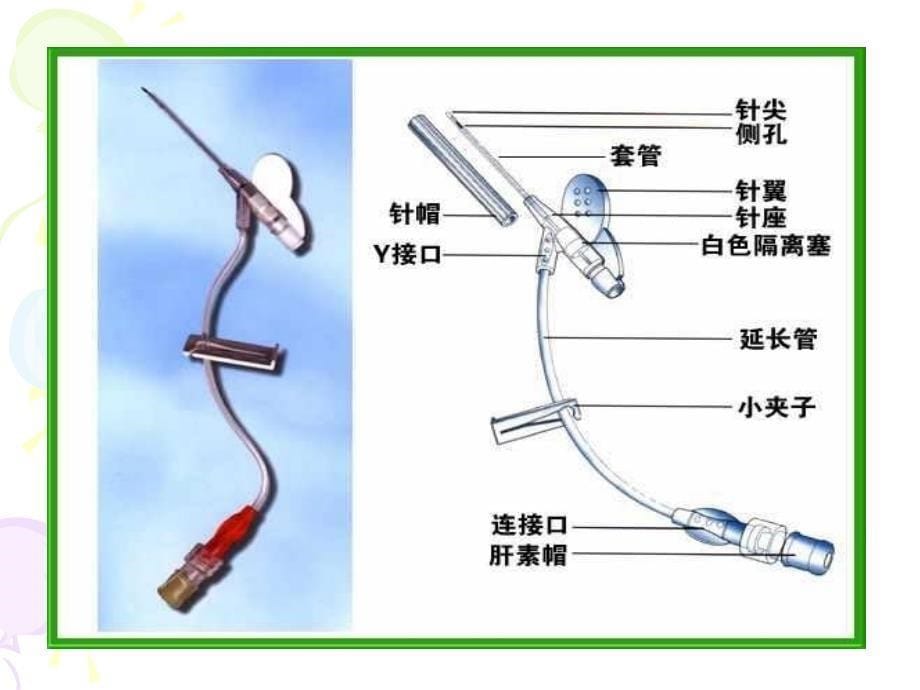 浅静脉留置针应用及维护教案资料_第5页