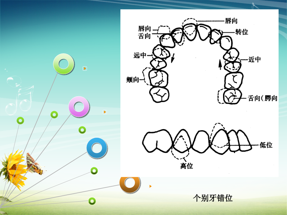 第三章 错合畸形的临床表现及分类_第4页