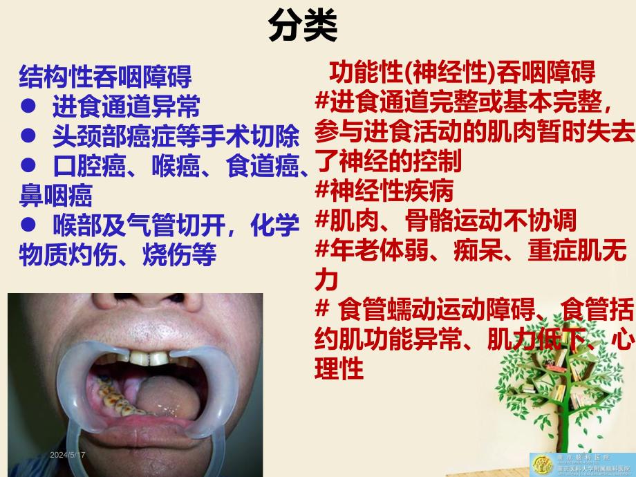 吞咽障碍的评定和康复治疗PPT课件.ppt_第4页