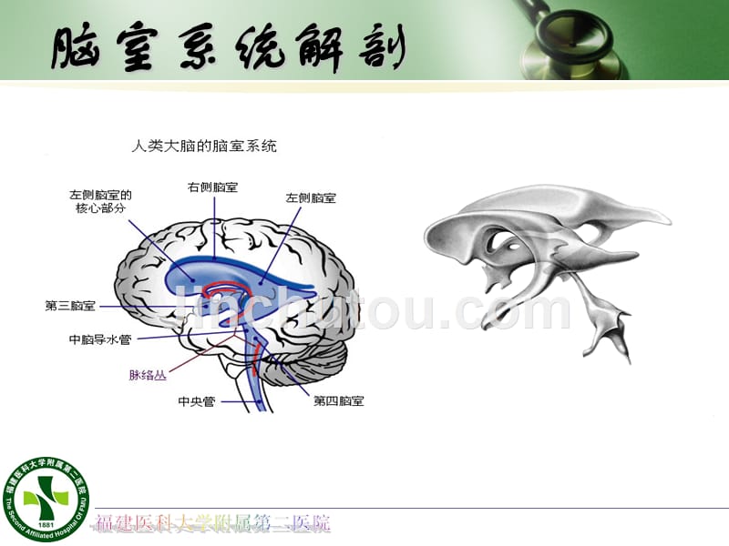 侧脑室外引流PPT课件_第2页