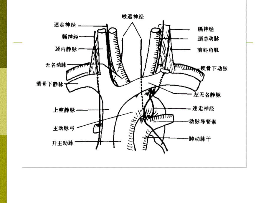 纵隔大血管断层解剖影像_第3页