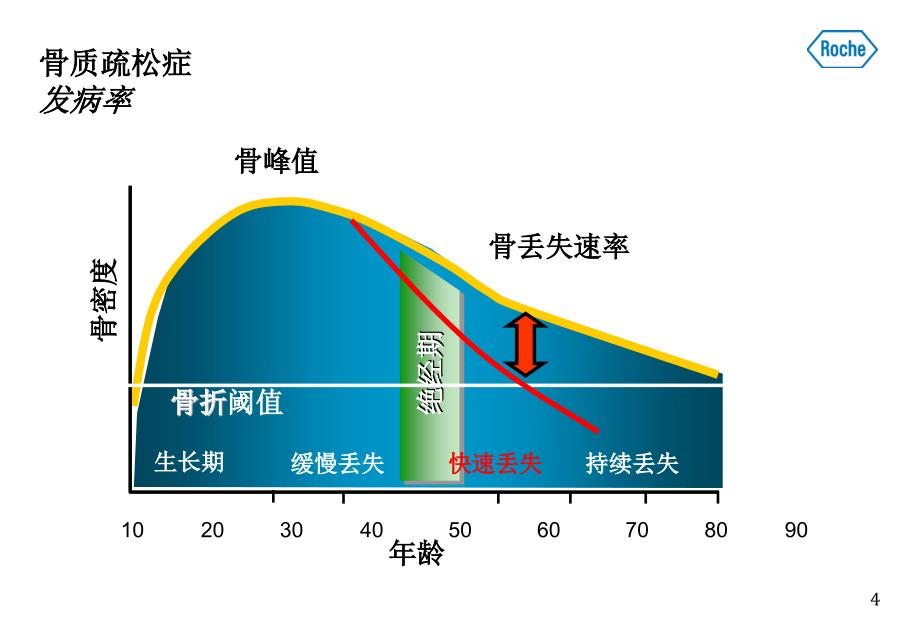 骨代谢标志物与骨质疏松症知识PPT课件_第4页