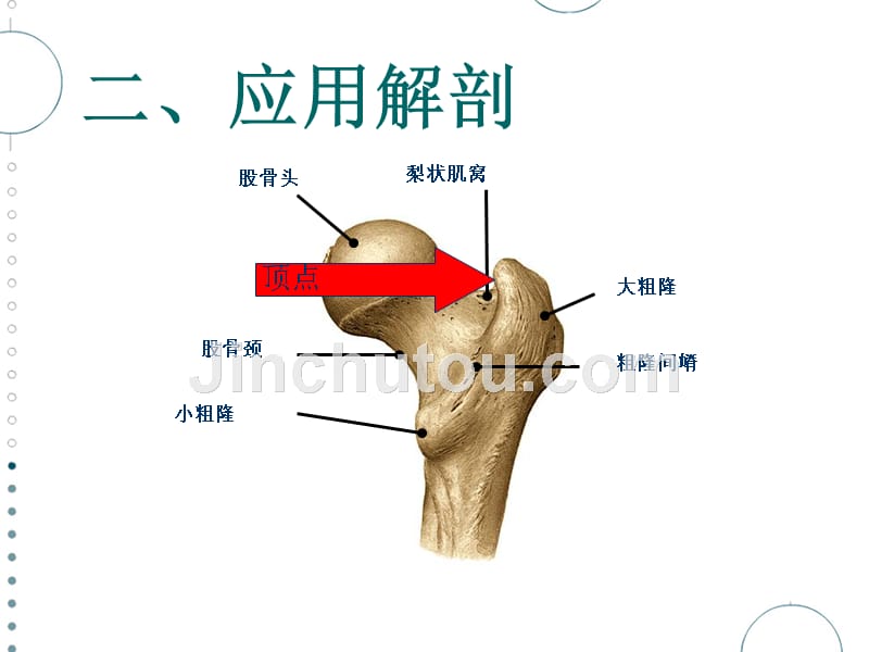 股骨转子间骨折的临床诊断及治疗PPT课件_第4页