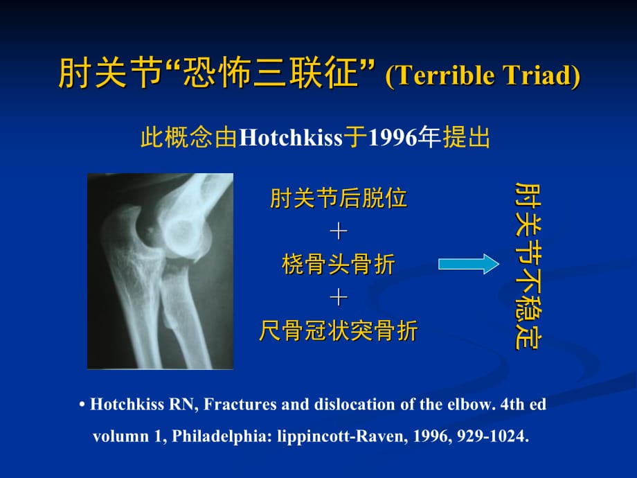 肘关节恐怖三联征的规范化外科治疗知识PPT课件_第2页