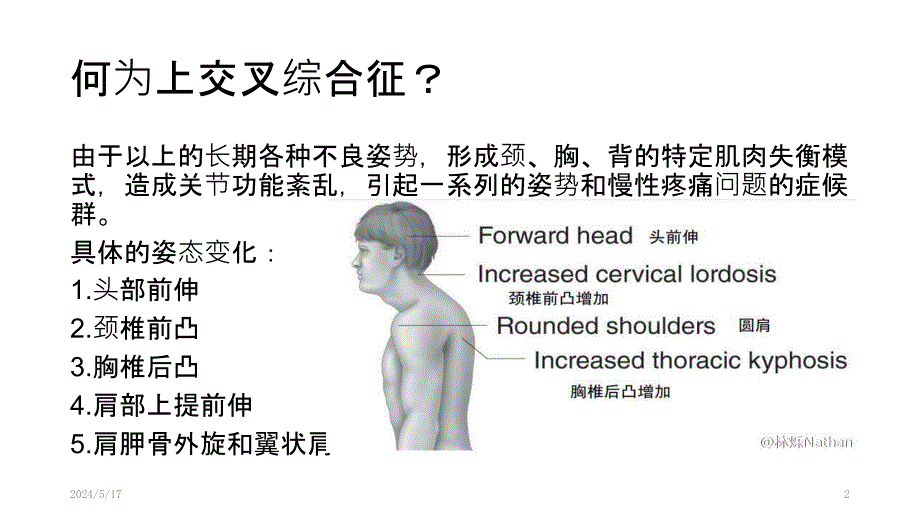 上交叉综合征的肌肉失衡及处理PPT课件.pptx_第2页