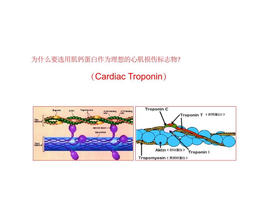 高敏心肌肌钙蛋白TPPT课件_第4页